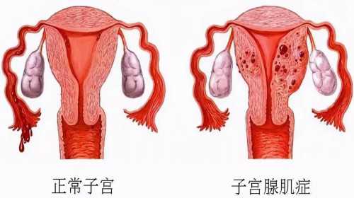 泰国三代试管性别会有错吗,两步移植法移植两个胚胎成双胞胎的多吗？